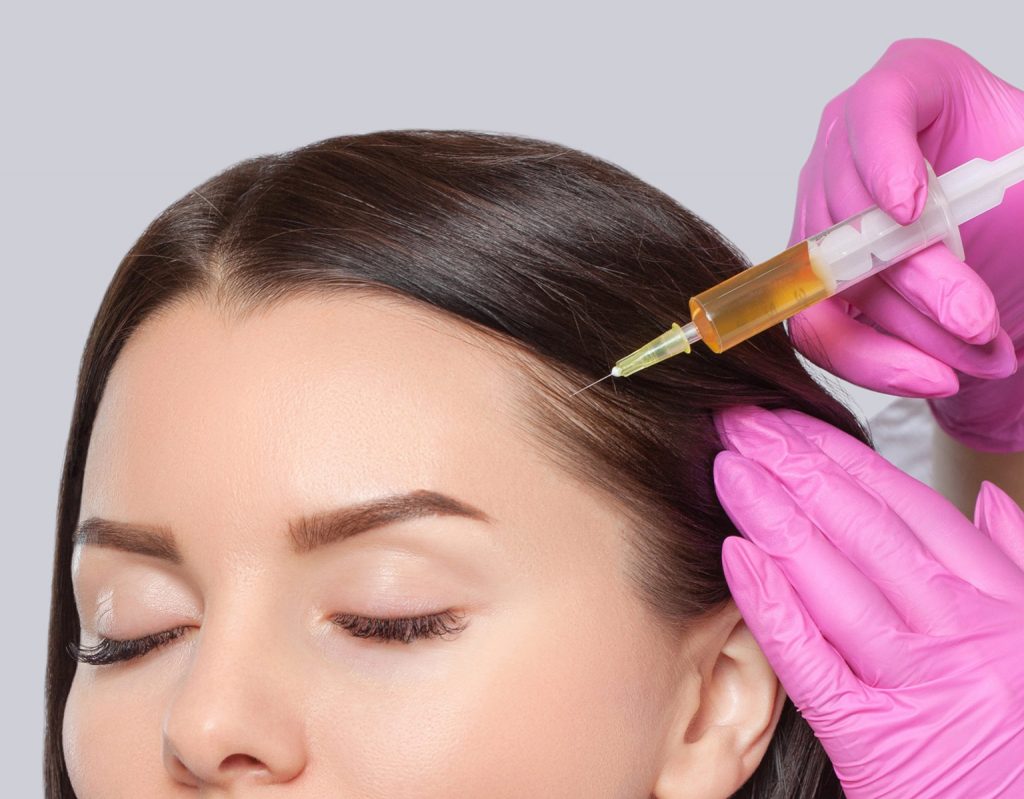 PRP Hair Restoration Treatment