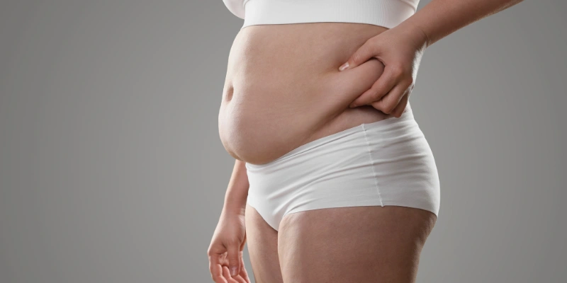 Is Cryolipolysis Safe? What You Need to Know