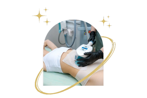 What Is Cryolipolysis?