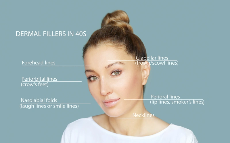 dermal fillers before and after​