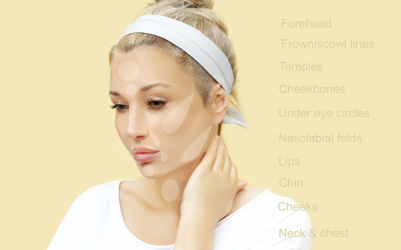 what are the most popular dermal fillers