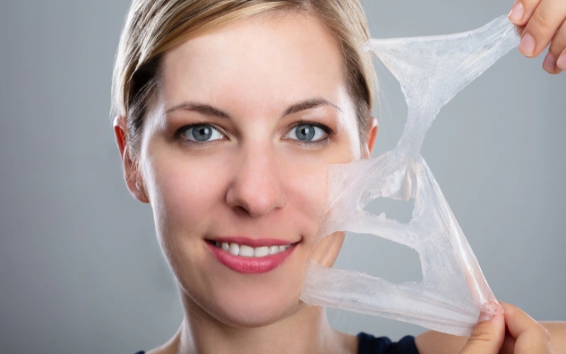 What is a Chemical Peel
