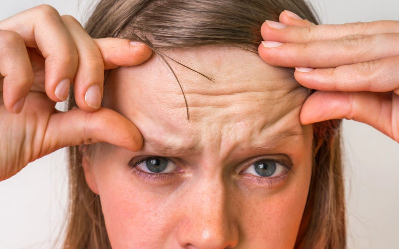 Conclusion on the Duration of Anti-Wrinkle Injections